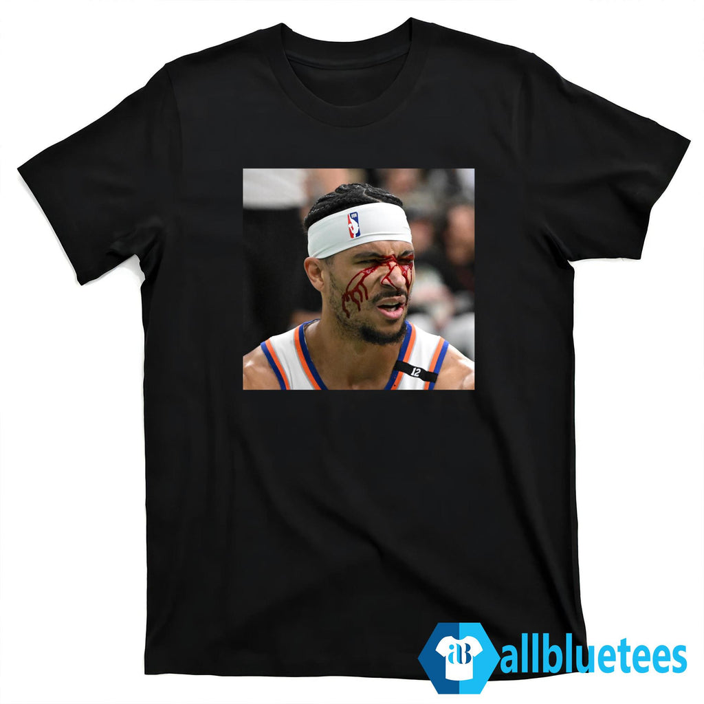 Josh Hart After Getting Elbowed In The Face Shirt